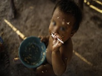 Este año 81 niños han muerto por desnutrición