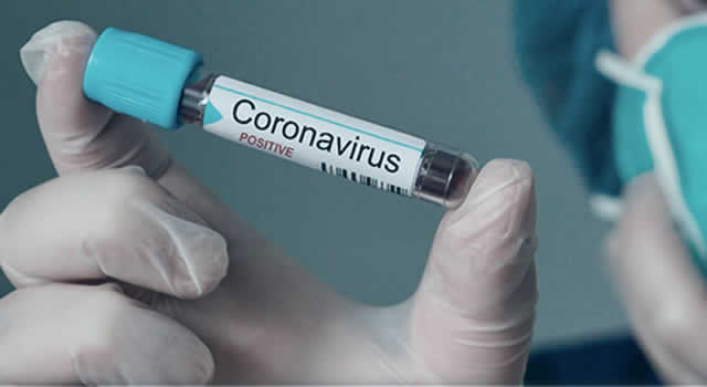 No frena incremento  de casos por coronavirus en Soacha, hoy se conocieron 38 nuevos contagios