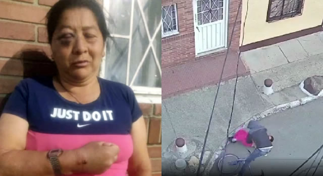 Ladrón atacó a mordiscos a una mujer en Bogotá por robarle el celular