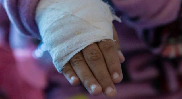 Diciembre deja un balance preocupante de lesionados por pólvora en Cundinamarca