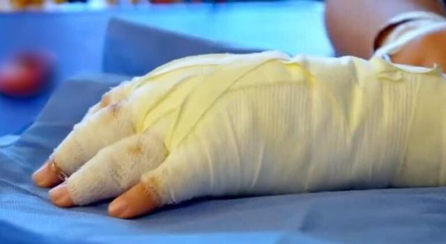 Diez lesionados con pólvora dejó la celebración de Navidad en Bogotá