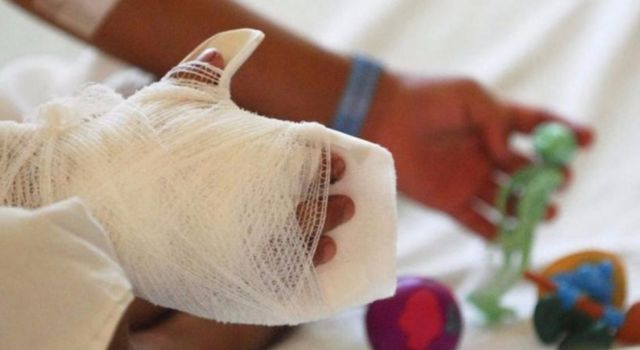 Reporte preliminar de Bomberos registra lesiones por pólvora en 26 municipios de Cundinamarca