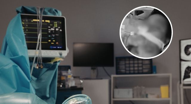 Más de 20 días en UCI: el drama de una joven que sobrevivió a un ataque en Soacha